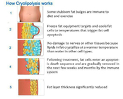 Double Chin 5 In 1 40k Cavitation Cryolipolysis Fat Freeze Slimming Machine